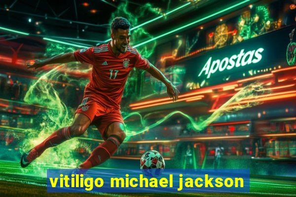 vitiligo michael jackson